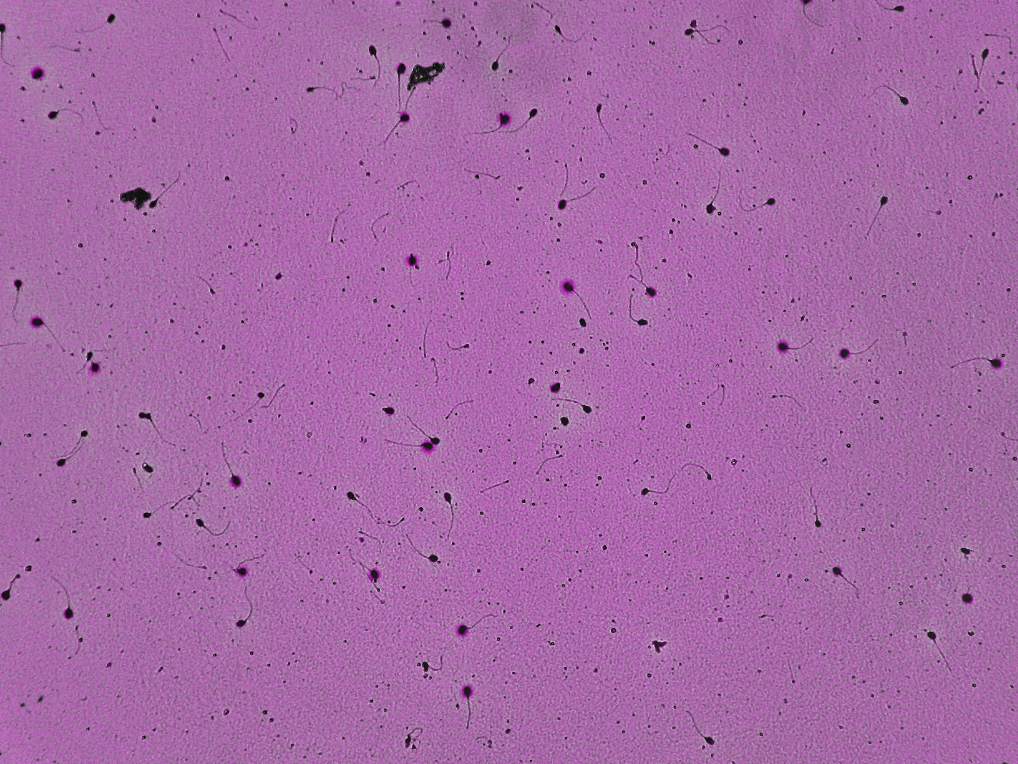 Representative microscopy field