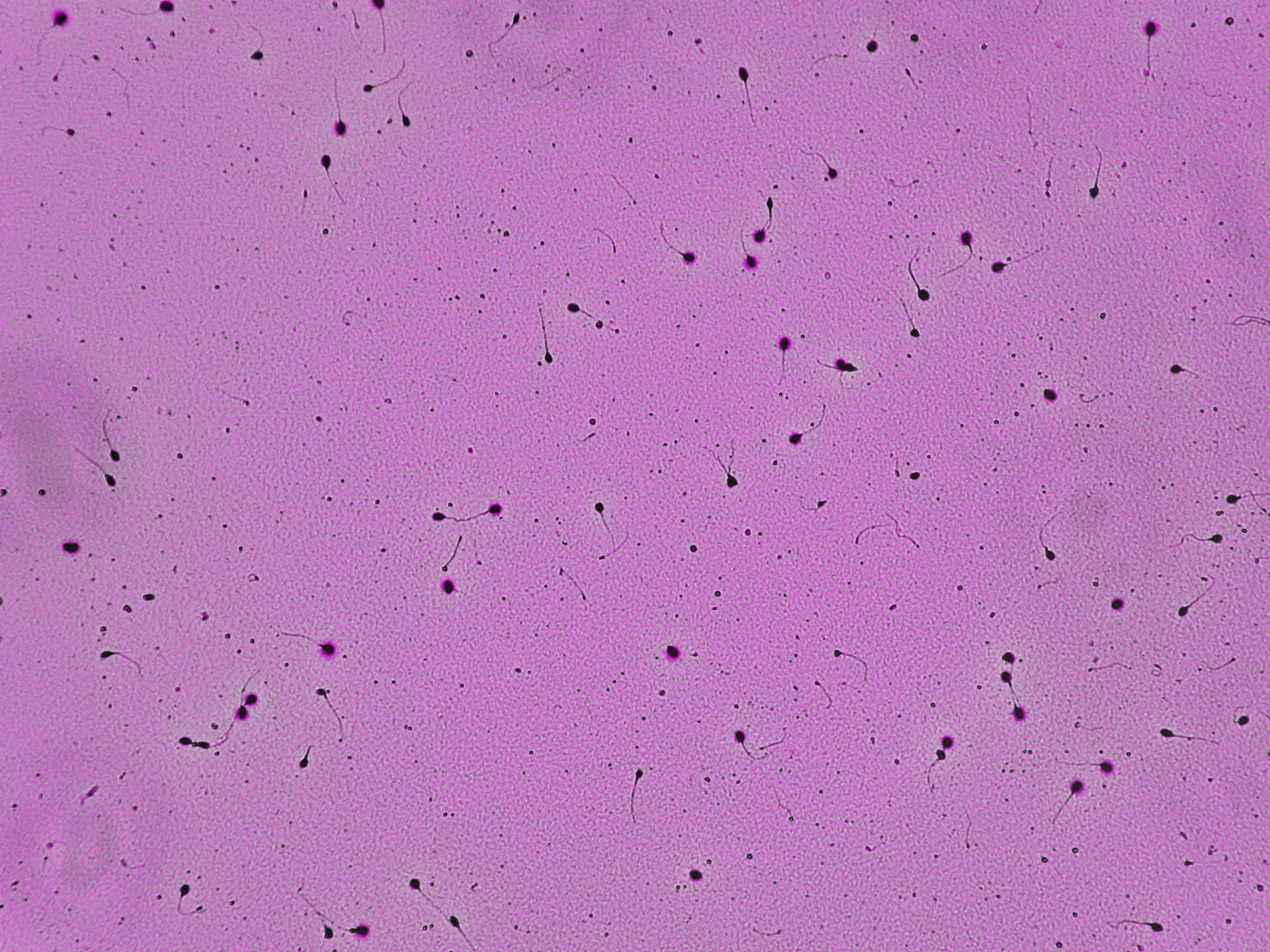 Representative microscopy field