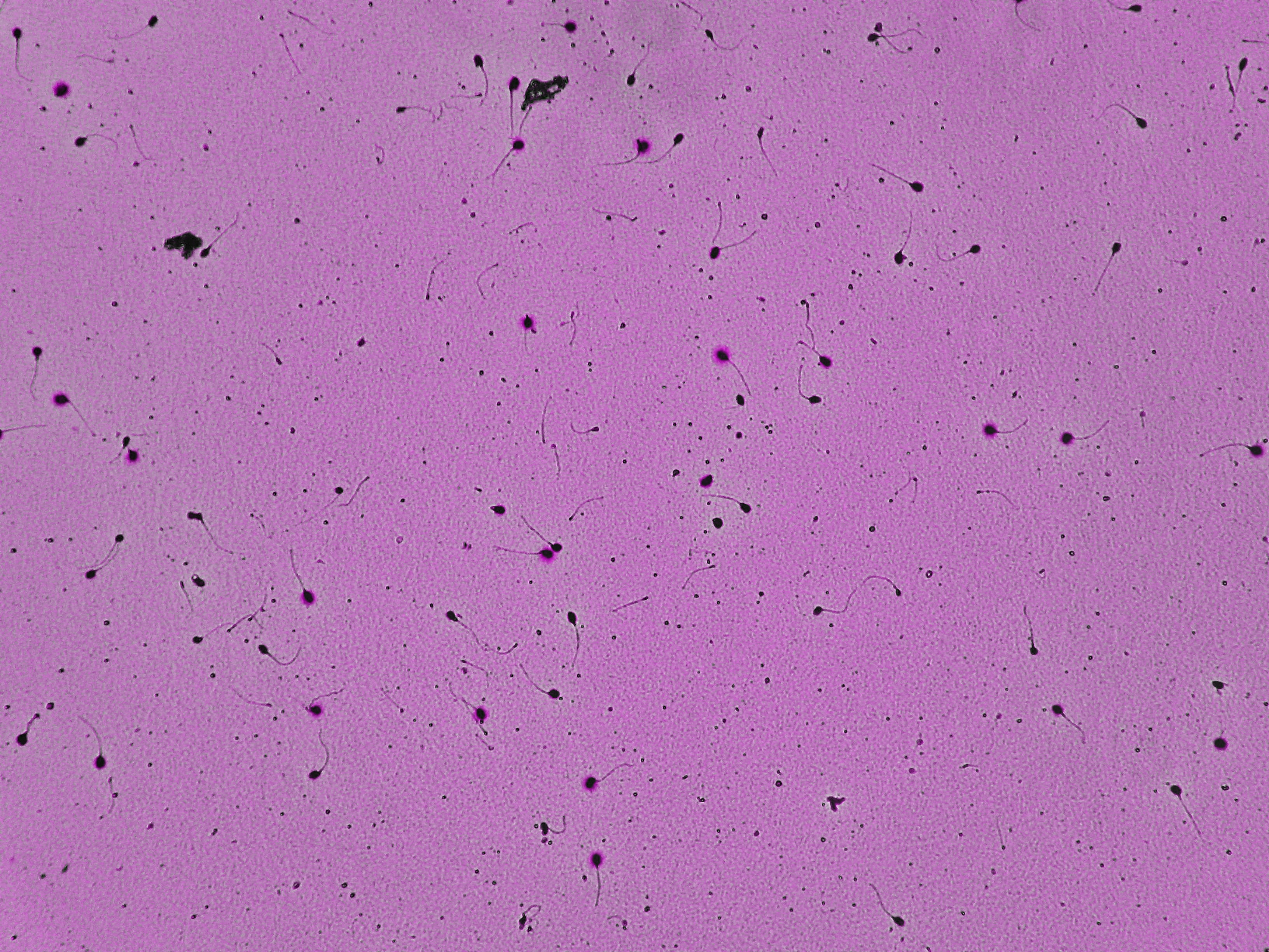 Representative microscopy field