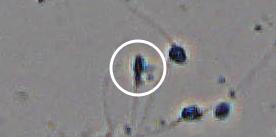 Flagged cell 11 from field 13