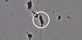 Flagged cell 15 from field 13