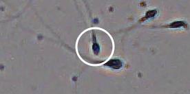 Flagged cell 9 from field 13